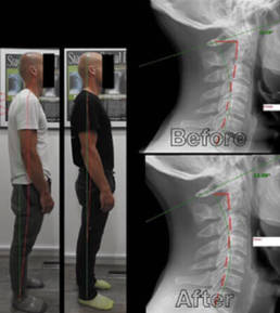 Revolution Chiropractic - The Revolution Difference 2 (1)