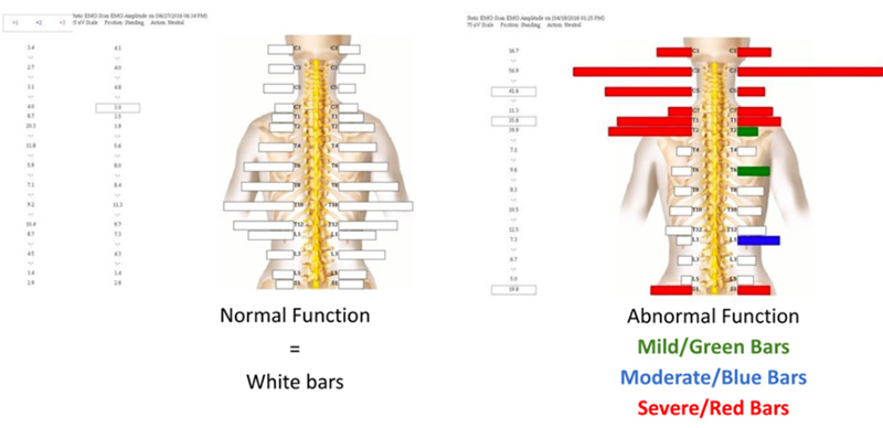 What Do I Need To Know Before My NeuroStructural Examination - 2